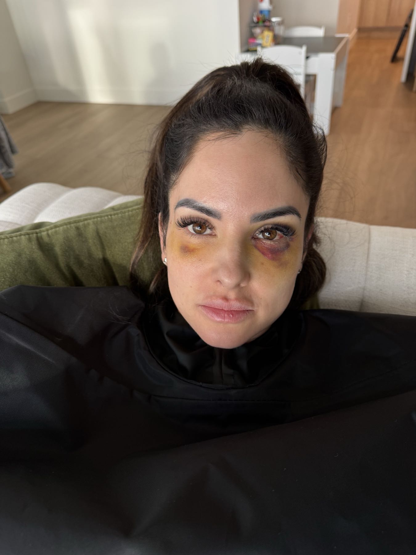 Post-procedure recovery before CO2 Suit